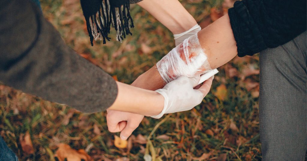 علاج الحروق