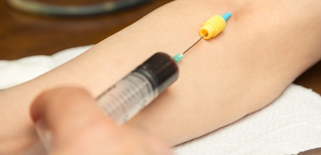 الحقن بابر الحديد